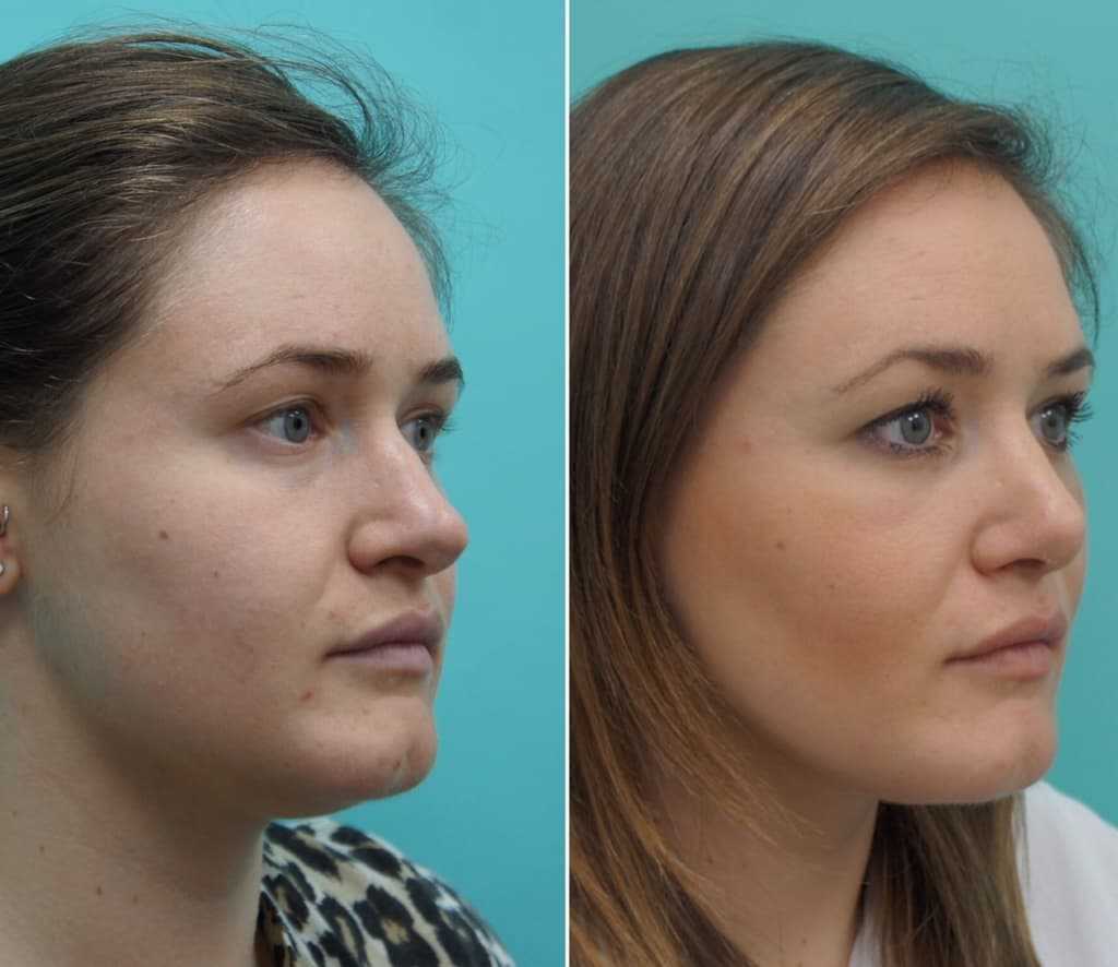 Как сделать полное лицо более худым при помощи макияжа: советы от визажистов