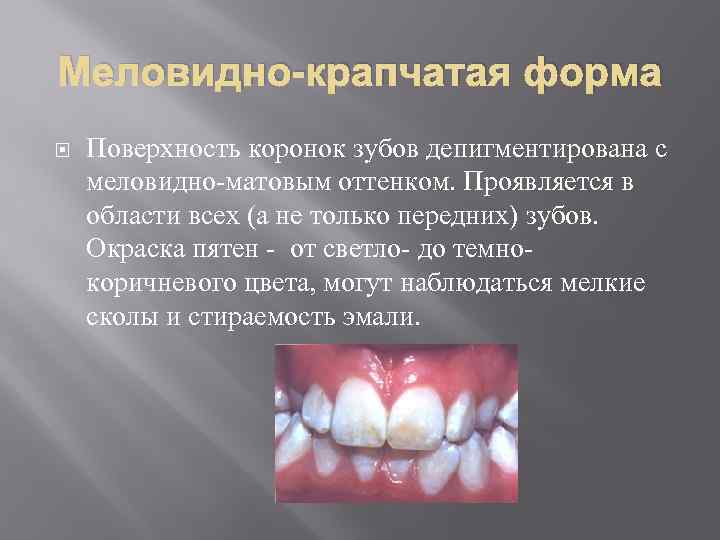 Фторид и его эффективность применения в стоматологии