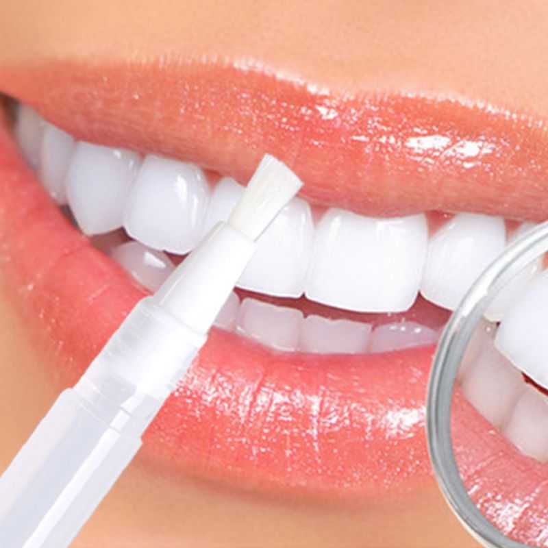 Лучшие способы отбеливания зубов | виды отбеливания в стоматологии и домашних условиях