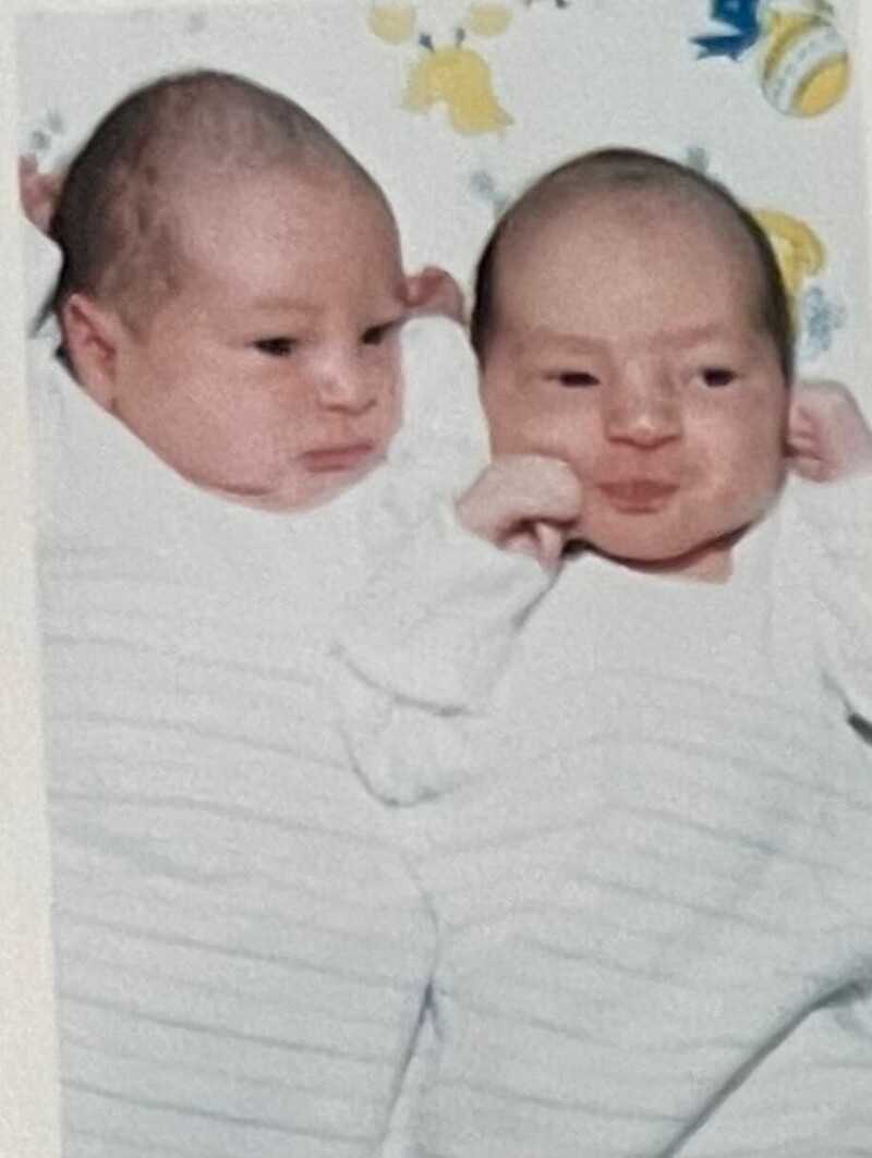 Как выглядят самые непохожие близнецы в мире: братья и сестры с разным цветом кожи