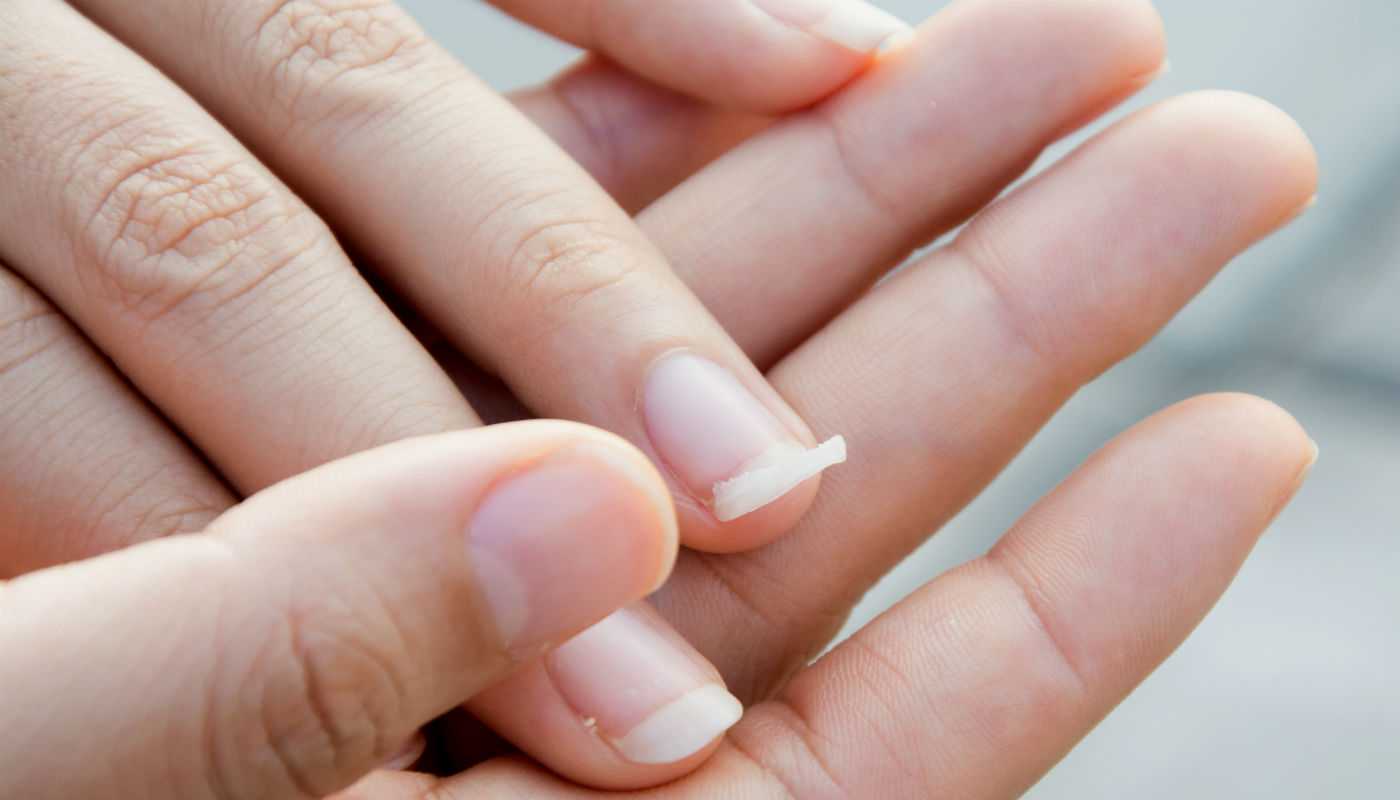 Как укрепить ногти в домашних условиях - простые рецепты и отзывы
