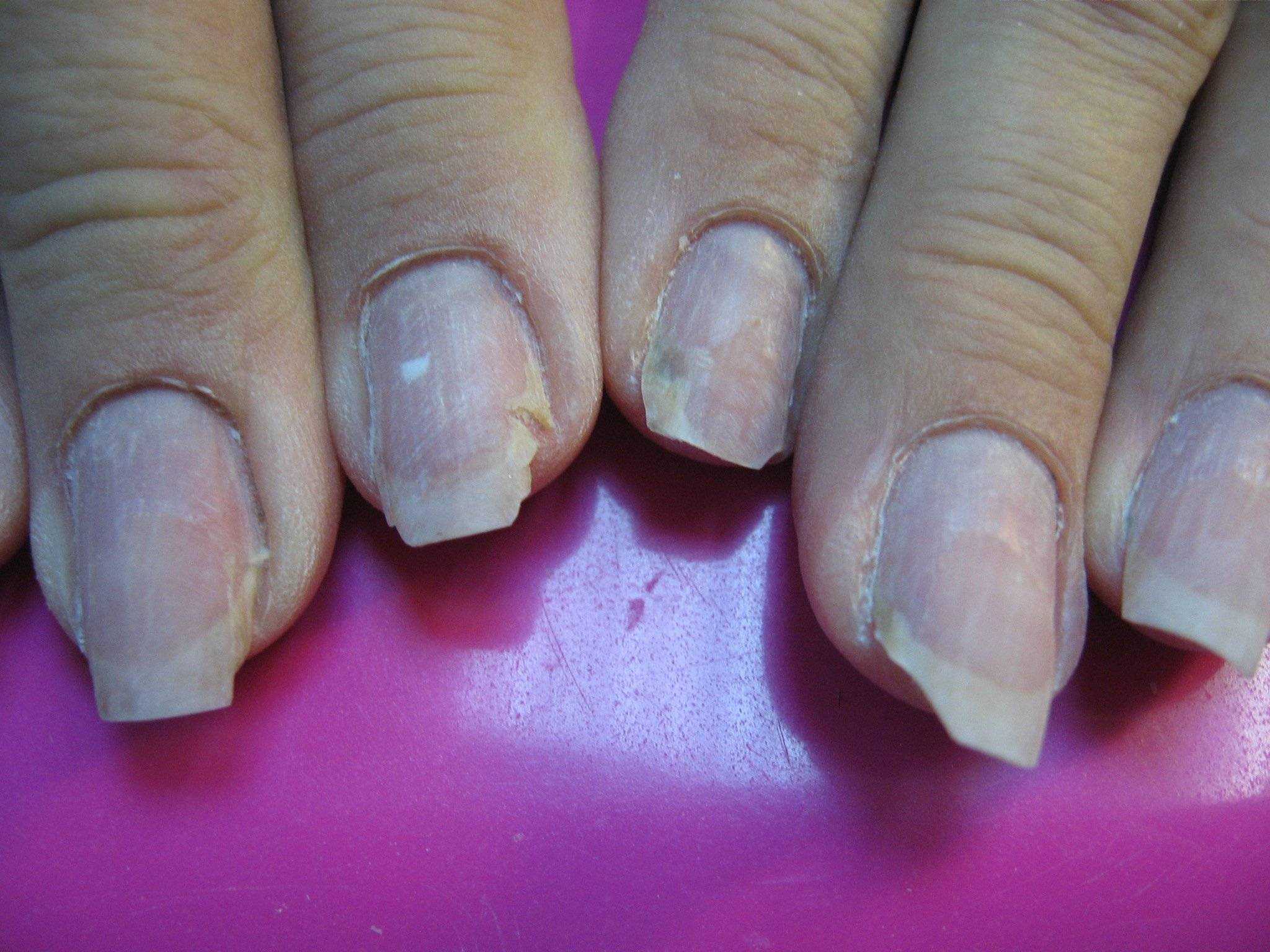 Наращивание ногтей, плюсы и минусы - best nails блог татьяны cool