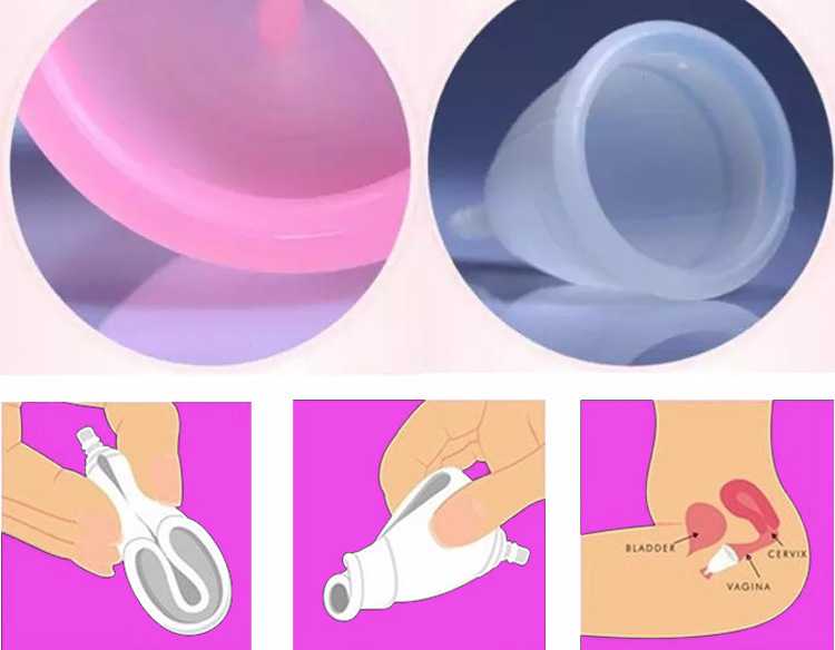 Менструальная чаша: что это, какая лучше - силиконовая или полиэтиленовая, как выбрать, вставлять, стерилизовать капу