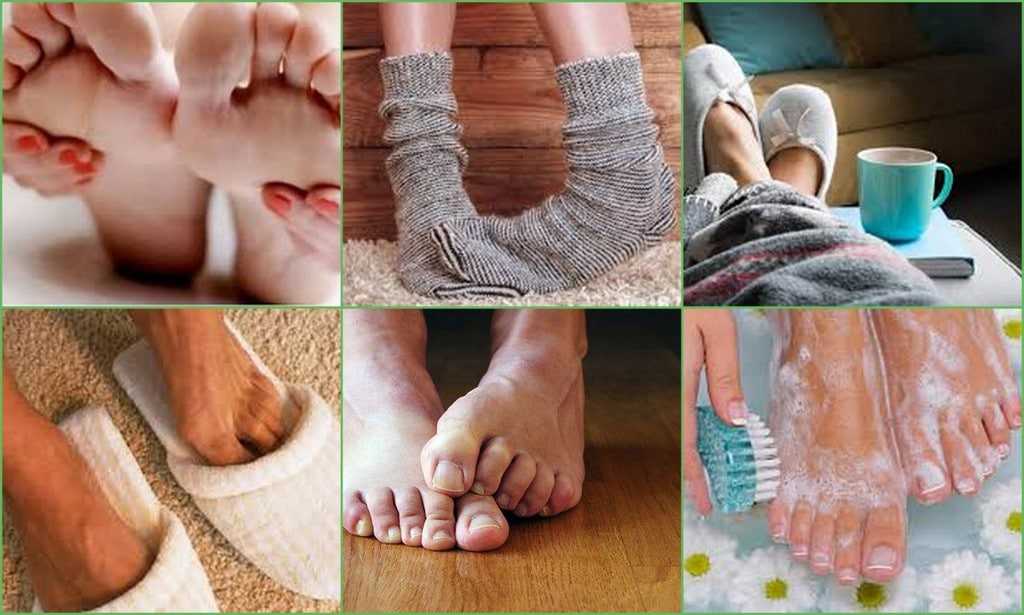 Почему сильно потеют ноги - причина и лечение