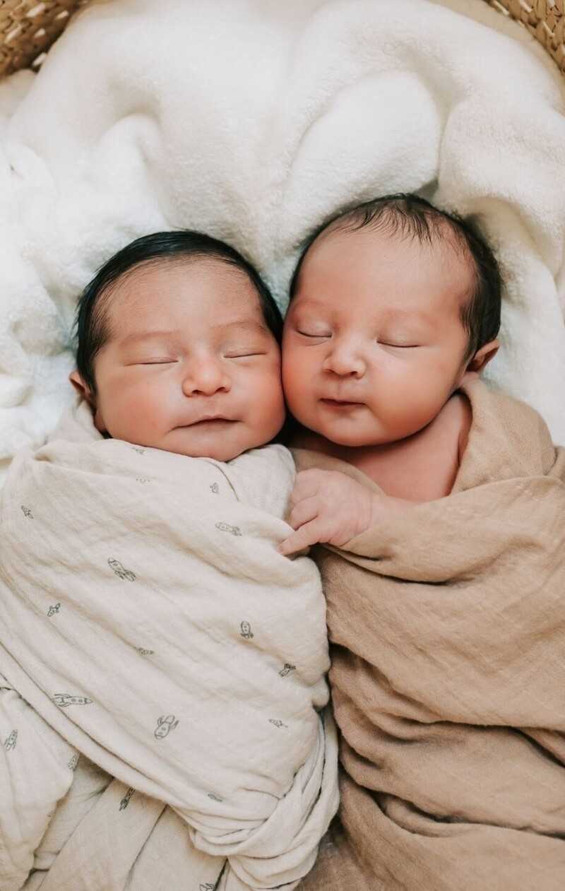 10 историй необычных близнецов, о которых вы не знали