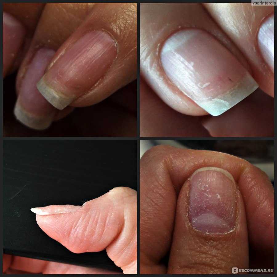 Быстро восстановить ногти после геля