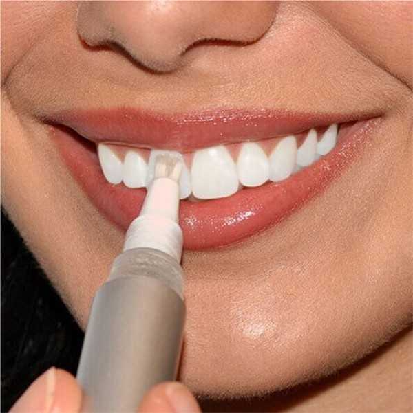 Какое отбеливание зубов самое безопасное и эффективное: мнение эксперта