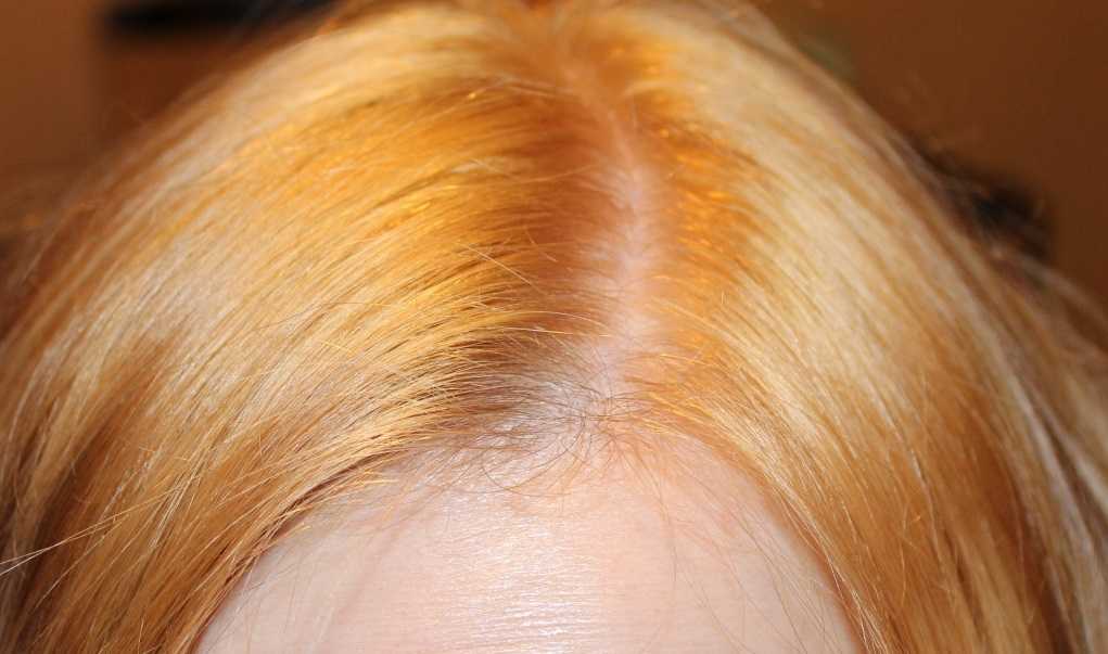 Как убрать рыжину с волос: эффективные методы, список необходимых средств, советы парикмахеров - janet.ru