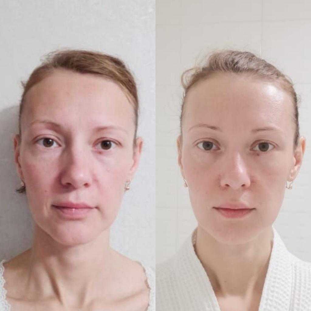 Как сделать лицо худым с помощью макияжа | glaziki.com